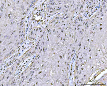 PPM1G Antibody