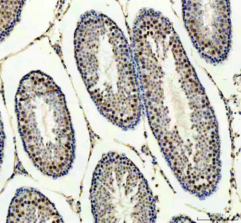PPM1G Antibody
