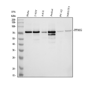 PPM1G Antibody