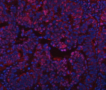 PPM1G Antibody