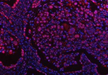 PPM1G Antibody