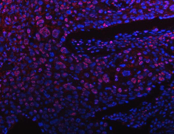 PPM1G Antibody