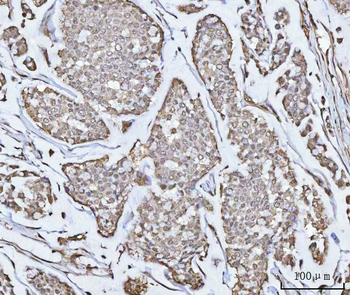 PPM1G Antibody