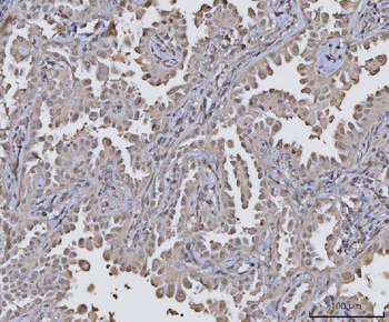 PPM1G Antibody