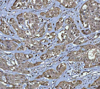 PPM1G Antibody
