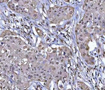 PPM1G Antibody