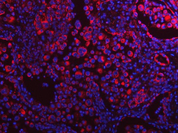 PLEKHA1 Antibody