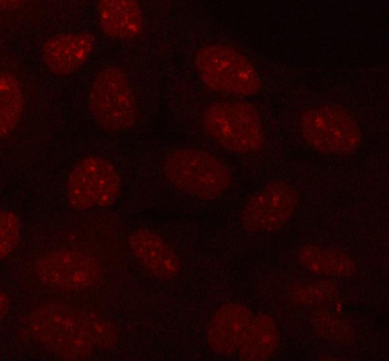 PLEKHA1 Antibody