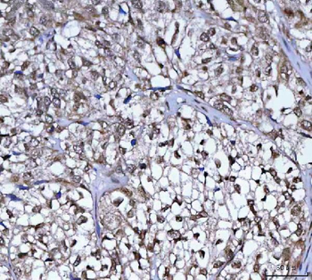 PLEKHA1 Antibody