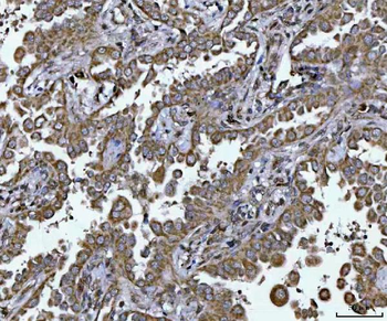 PLEKHA1 Antibody