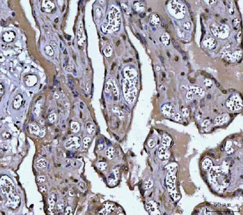 PLEKHA1 Antibody