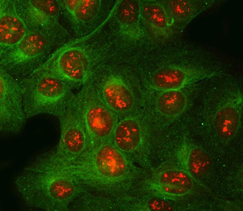 POLR2H Antibody