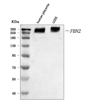 fibrillin 2/FBN2 Rabbit Polyclonal Antibody
