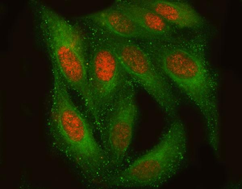 TM2D3 Rabbit Polyclonal Antibody