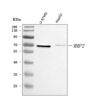 MMP2 Rabbit Polyclonal Antibody