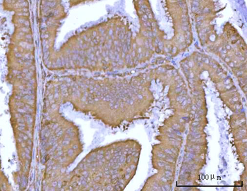 DR5/TNFRSF10B Antibody