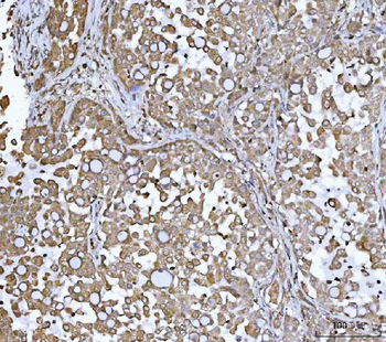 DR5/TNFRSF10B Antibody