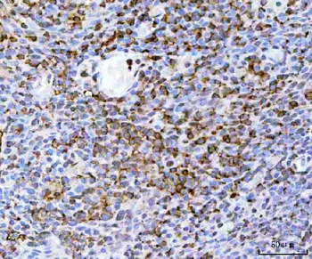 DR5/TNFRSF10B Antibody
