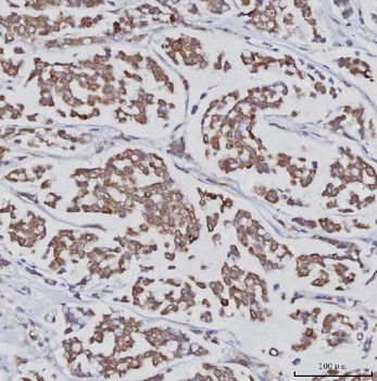 PLXDC2 Rabbit Polyclonal Antibody