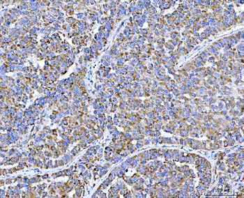 PLXDC2 Rabbit Polyclonal Antibody