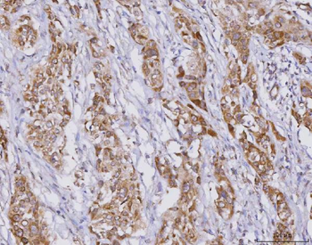 PLXDC2 Rabbit Polyclonal Antibody
