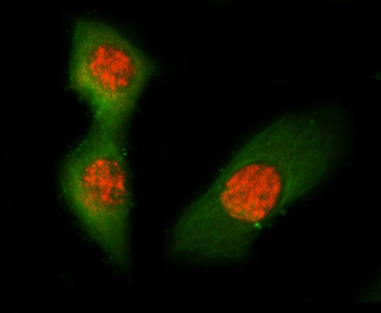 ASC/TMS1/Pycard Antibody