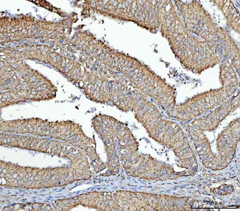 RPS13 Rabbit Polyclonal Antibody