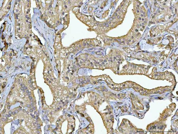 RPS13 Rabbit Polyclonal Antibody