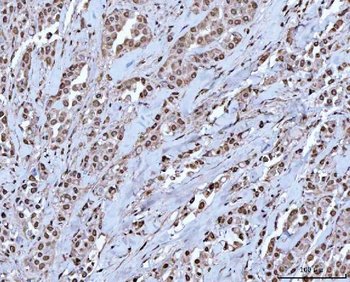 RBM15 Antibody
