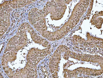 RBM15 Antibody