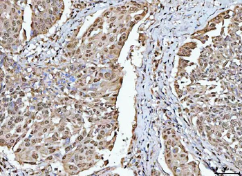 RBM15 Antibody