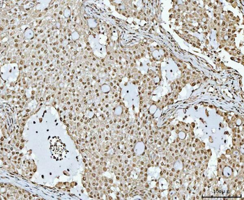 RBM15 Antibody