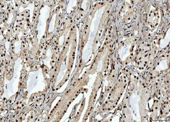 RBM15 Antibody