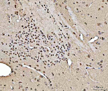 RBM15 Antibody