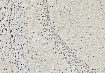 RBM15 Antibody