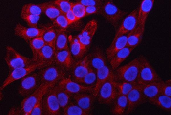 RAB39A/B Antibody