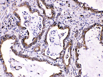 Caspase 8/CASP8 Antibody
