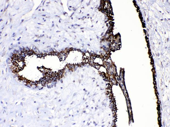 Caspase 8/CASP8 Antibody