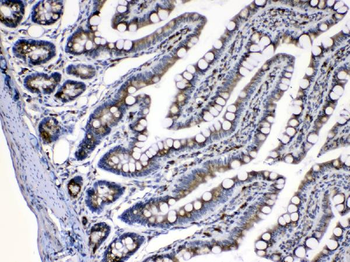 Caspase 8/CASP8 Antibody