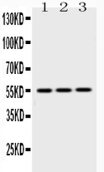 Caspase 8/CASP8 Antibody