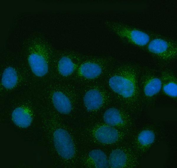 MIA3 Rabbit Polyclonal Antibody