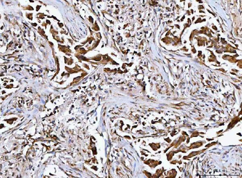 MFAP3 Rabbit Polyclonal Antibody