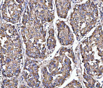 MFAP3 Rabbit Polyclonal Antibody