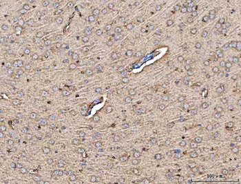 MFAP3 Rabbit Polyclonal Antibody