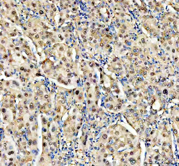 NUDT5 Rabbit Polyclonal Antibody
