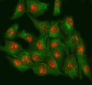 NSUN2 Antibody