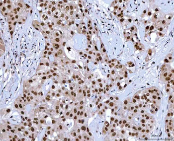 NSUN2 Antibody