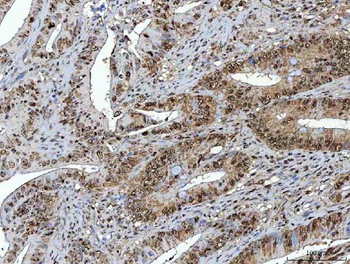 NSUN2 Antibody