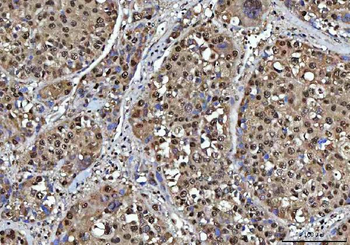 NSUN2 Antibody