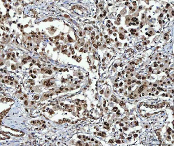 NSUN2 Antibody